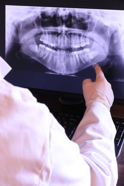 Best Emergency Tooth Extraction in Grand Coulee, WA