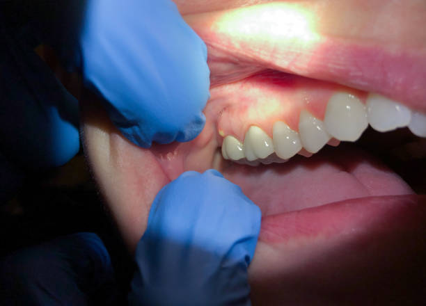 Best Emergency Broken Tooth Repair in Grand Coulee, WA